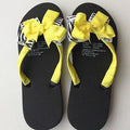 Yellow Zebra Flip Flops